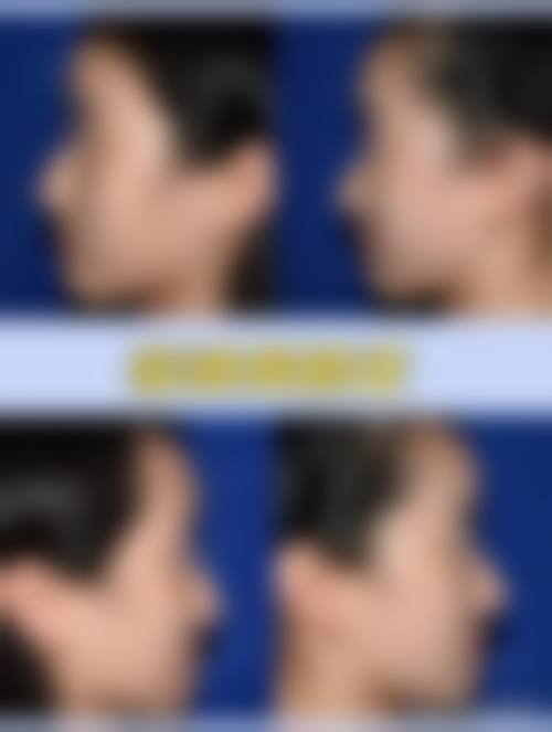 五、兰州中医医院实例