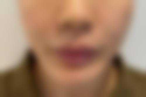 八、北京幻颜医疗美容真实的顾客评价如下：