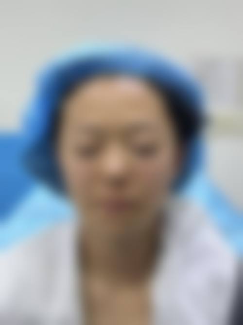 丁月医生在哪家医院怎么预约?