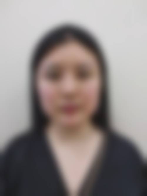 四、南宁艾媚儿整形医院实例