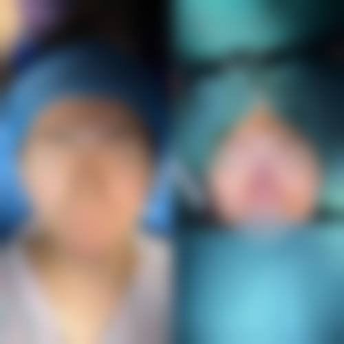 七、南宁艾媚儿整形医院真实的顾客评价如下：