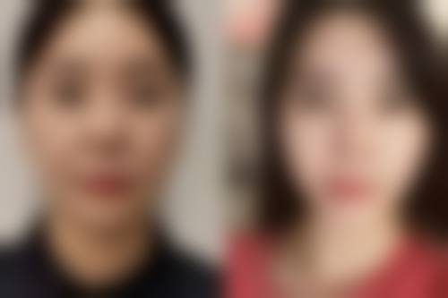 五、韩国女友整形外科实例