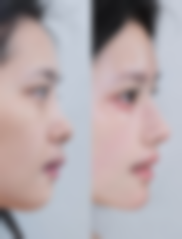 五、杭州迪美医疗美容实例