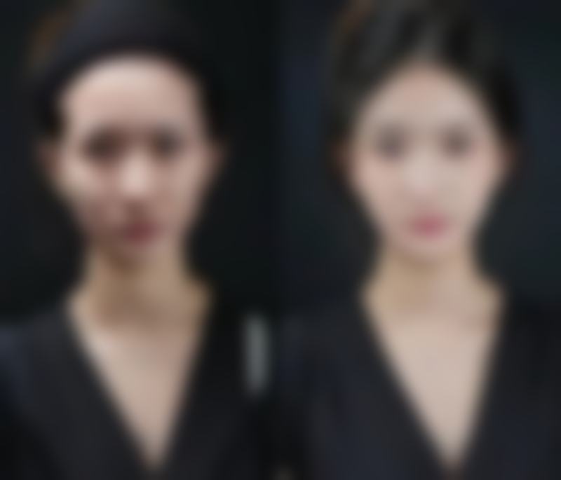 八、韩国女友整形外科真实的顾客评价如下：