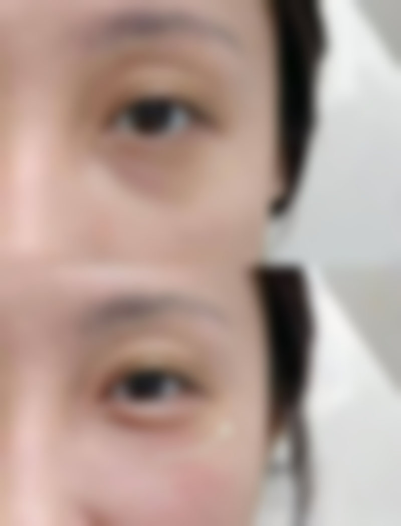 芦荟保湿凝胶能否去除疤痕？揭秘其对新生表浅疤淡化及改善疤痕外观的潜在功效 