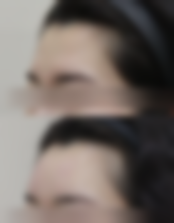 五、韩国FARBE法尔贝整形医院实例