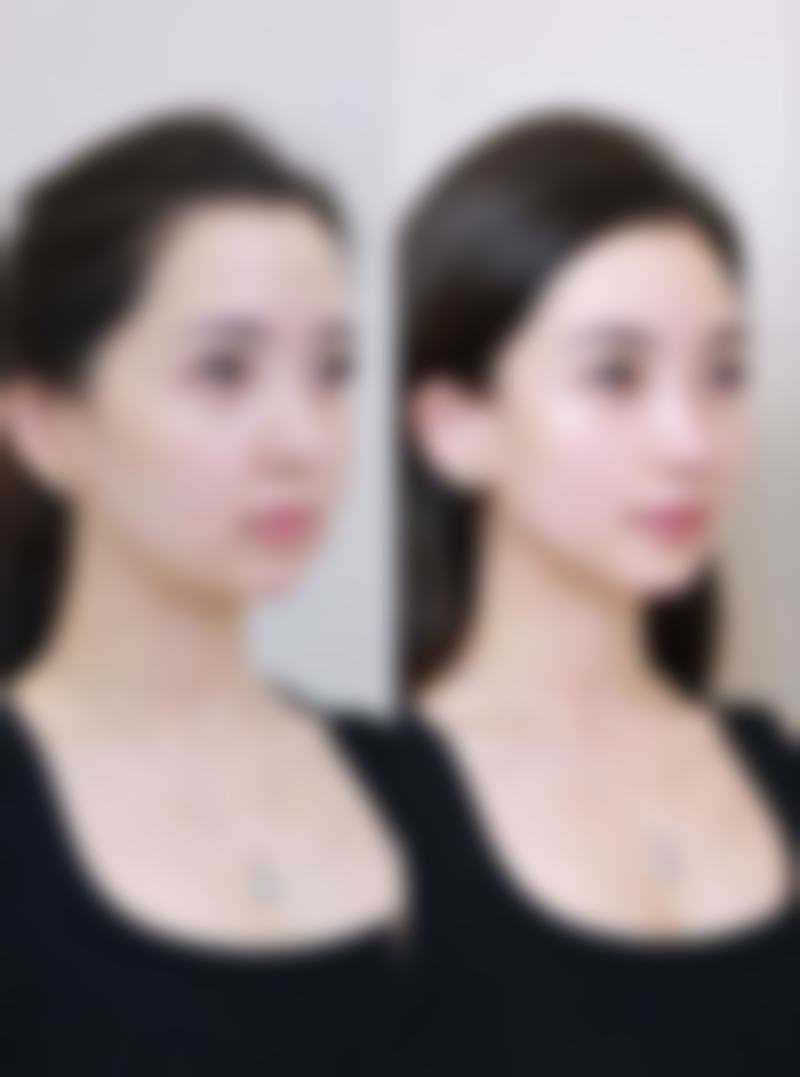 冷热交替敷眼,消眼袋有神奇成效