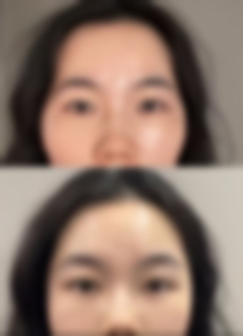 怎样快速消除黑眼圈和眼袋？物理/偏方护理显神通