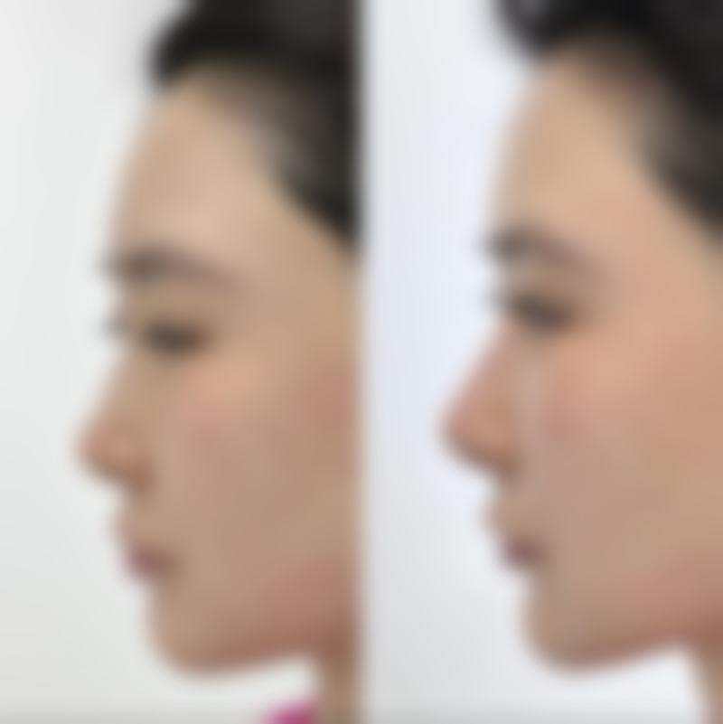 八、心斎桥Yume Beauty Clinic真实的顾客评价如下：