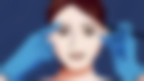 双眼皮术后疤痕增生别怕！精细护理不可少