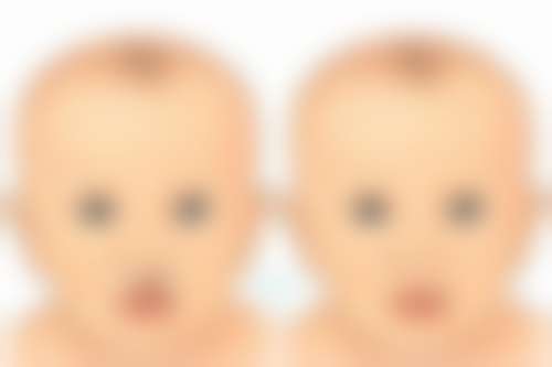 就医建议，让专精医生帮你搞定眼袋