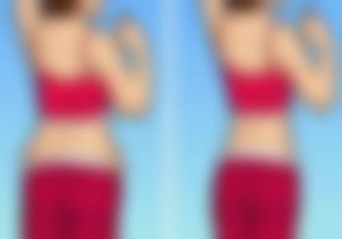 双眼皮术后疤痕增生别怕！多样治疗方式来帮忙