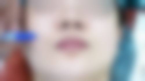 六、毕节圣柏俐医疗美容门诊部价格表：（仅供参考）