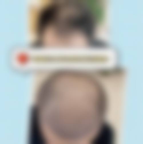 五、湖南发友汇植发门诊部怎么预约: