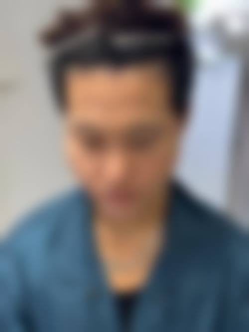 六、湖南发友汇植发门诊部价格表:(仅供参考)