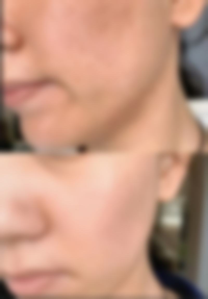 黑眼圈并非眼袋！形态特征大不同