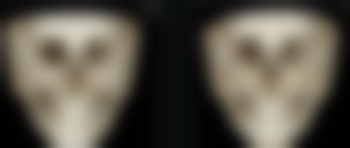 黑眼圈并非眼袋！改善方式差异大