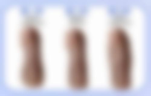 做完双眼皮究竟可不可以躺着睡？揭秘躺着睡对双眼皮恢复的积极影响与正确姿势