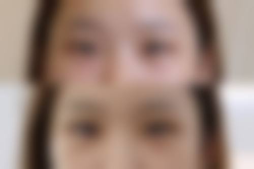 四、长春艾尔丽整形医疗美容门诊部实例