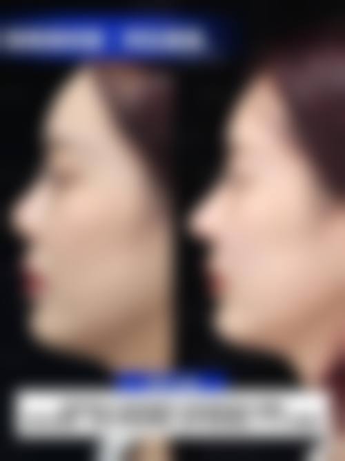 八、济宁整形美容外科诊所真实的顾客评价如下：