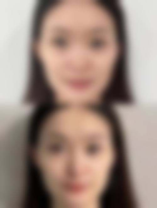 六、Fact整形外科怎么预约：