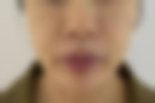 七、宿迁荷立谷医疗美容真实的顾客评价如下: