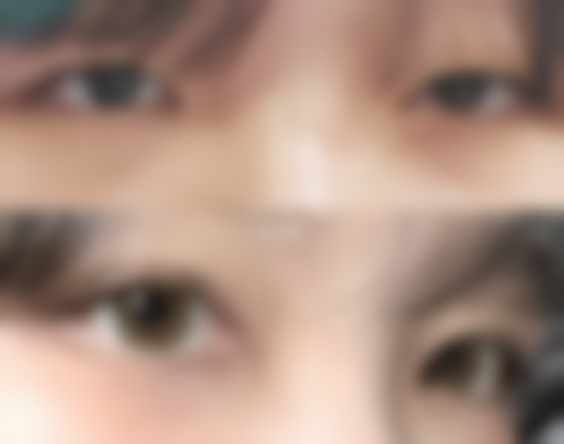 五、宿迁荷立谷医疗美容怎么预约: