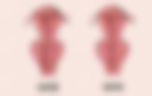 还在烦恼黑眼圈黑眼袋怎么去？分型而治+多元手段，全方位击退眼周烦恼！ 