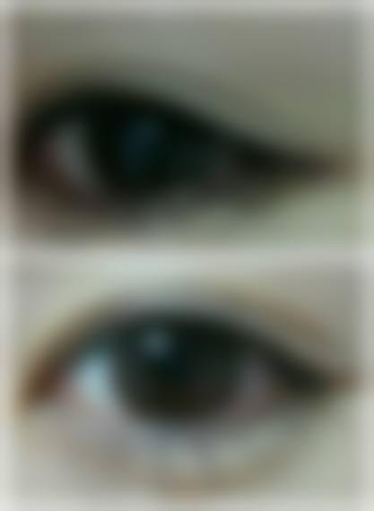 五、内蒙古包钢医院整形外科怎么预约：