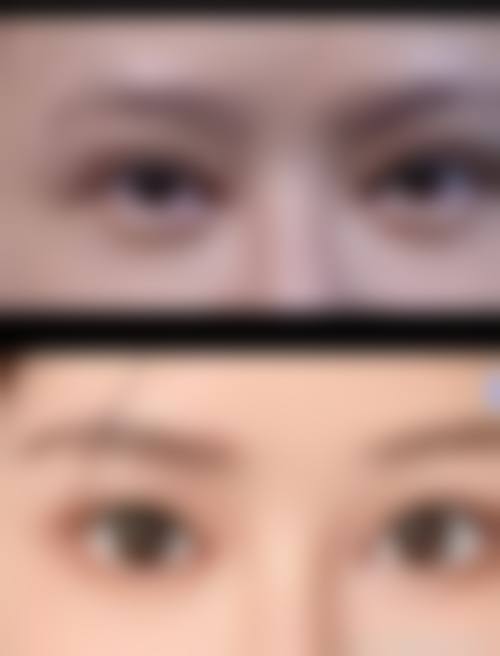 七、包头瑞薇整形医疗美容诊所真实的顾客评价如下: