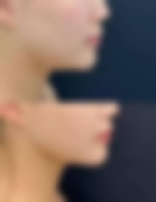 陈夫英医生在哪家医院怎么预约？