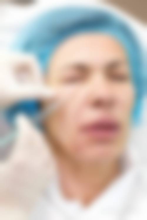 五、南京百筑整形医院实例