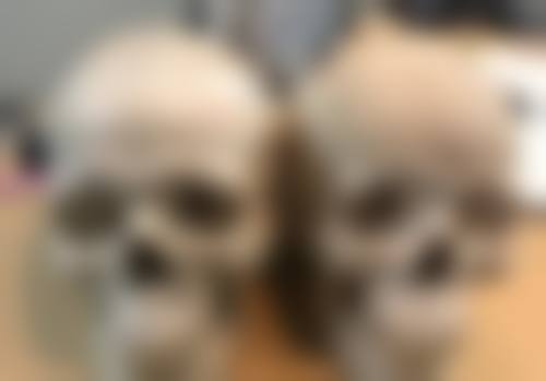 芦荟胶淡化疤痕的独特优势