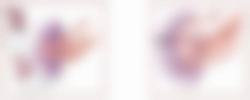 芦荟胶适合哪些疤痕？