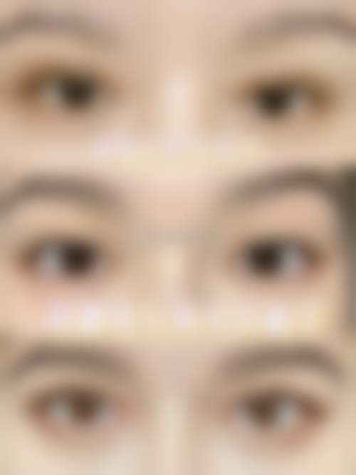 朴哲秀医生实例