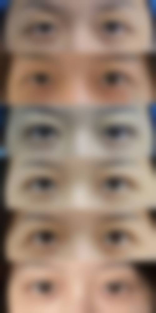 李艳英医生怎么样可靠吗？