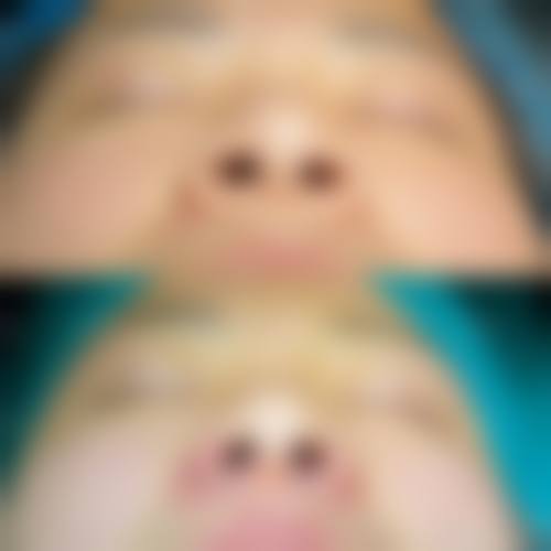 七、石家庄市第一医院整形美容外科价格表：（仅供参考）