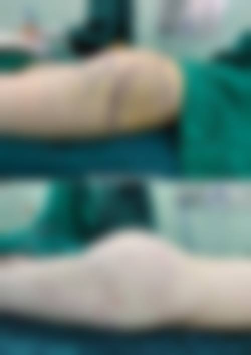 六、佳木斯天虹医疗美容门诊部怎么预约：