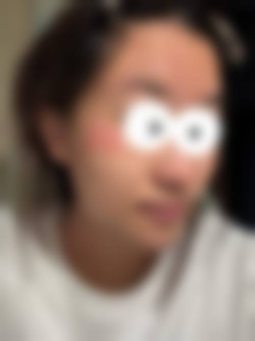 六、惠州美巢医疗美容门诊部怎么预约：