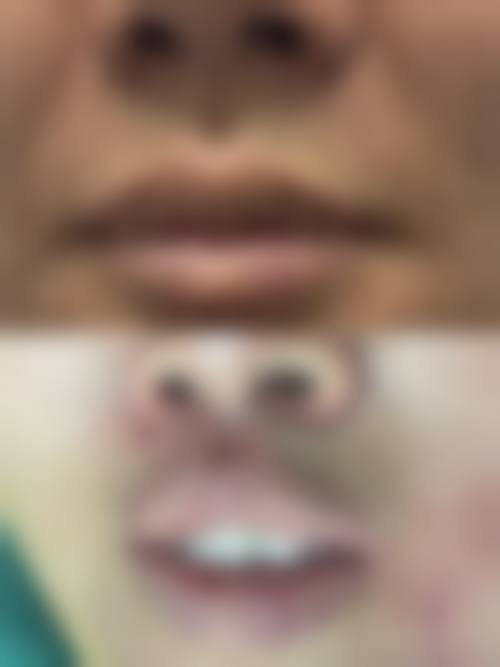 五、惠州美巢医疗美容门诊部实例