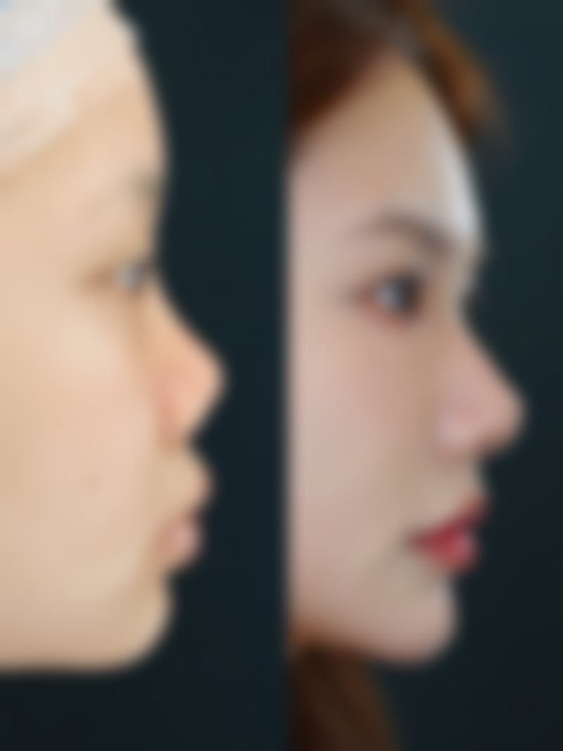 四、成都塑美大师医疗美容整形门诊部开展的主要项目和特色项目：