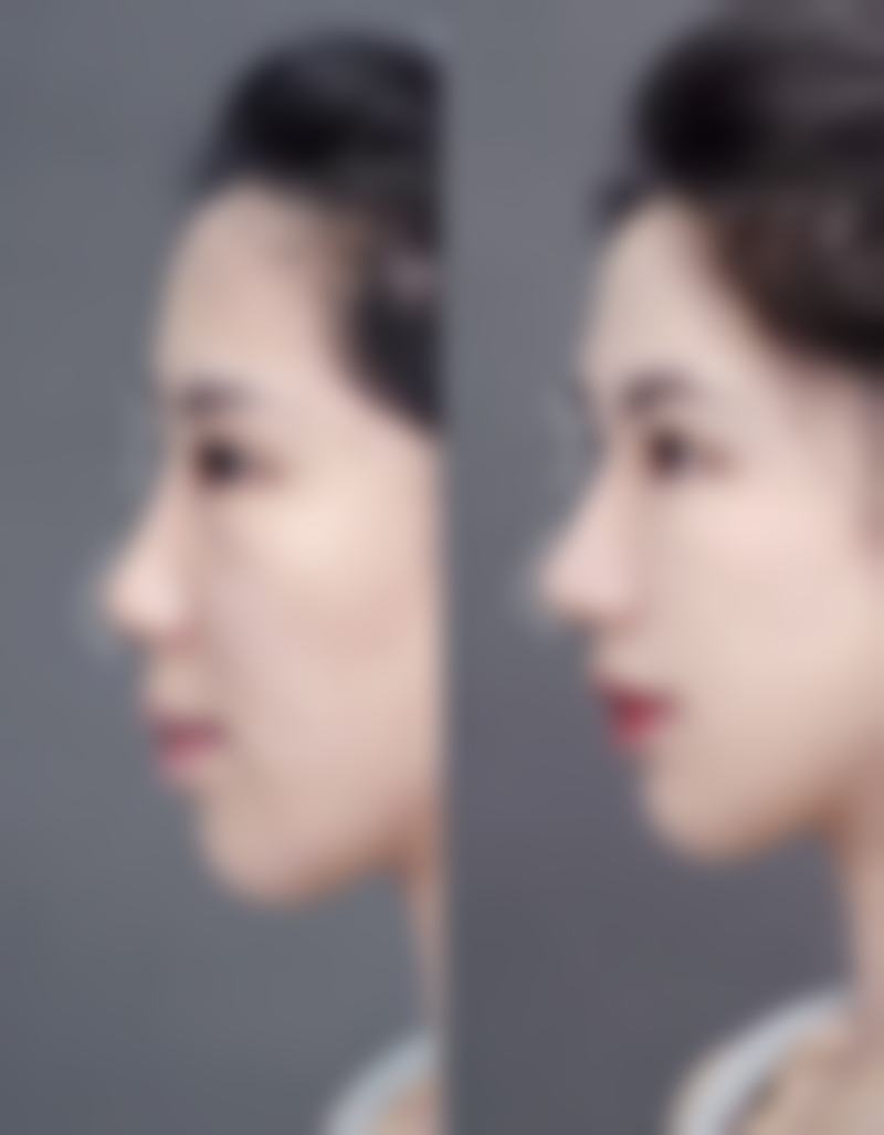 八、成都塑美大师医疗美容整形门诊部真实的顾客评价如下：