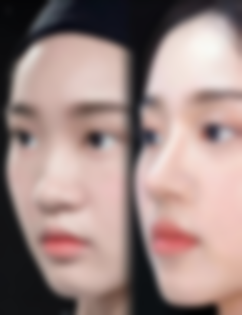 芦荟胶真能淡化疤痕吗？保湿抗炎促修复，助轻浅新疤焕新颜 