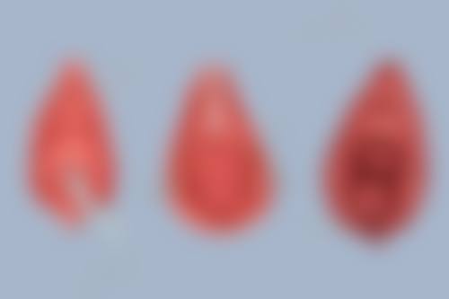 隆鼻全麻多久能醒?术后注意事项与优势展现