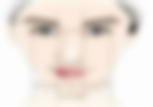 自体肋骨隆鼻究竟好不好?与其他隆鼻方式对比显优势