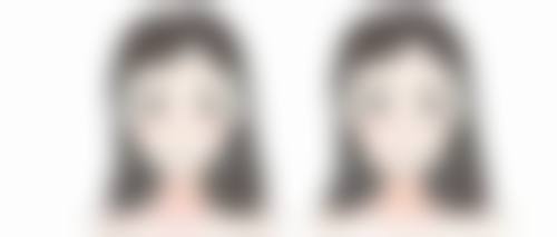 自体肋骨隆鼻究竟好不好?正面实例来说话