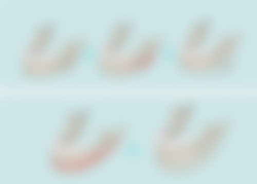 隆鼻全麻多久能醒?鼻综合手术苏醒时间大揭秘