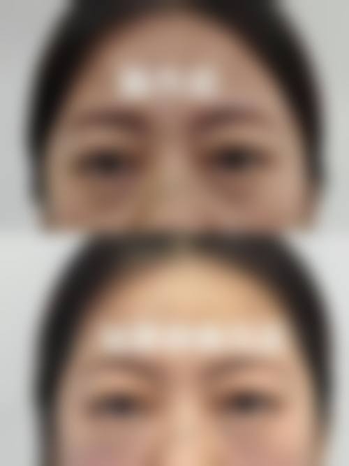 陈宇新医生实例