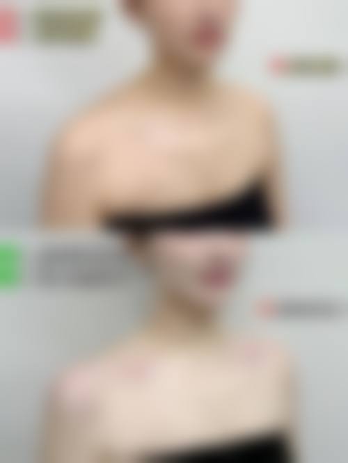 六、杭州雪然慕兮医美整形怎么预约：