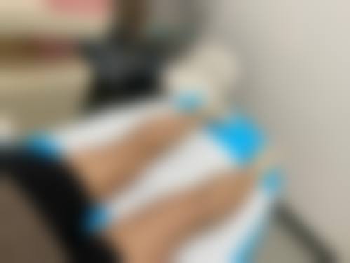 五、杭州雪然慕兮医美整形实例